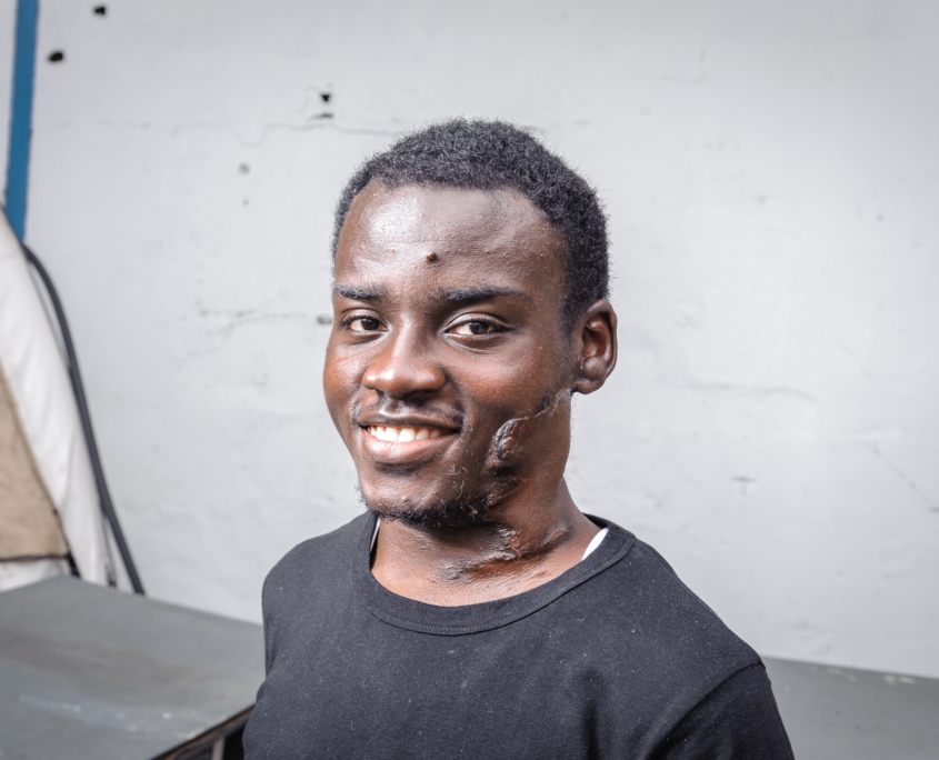 Maxfax Patient Bernard After