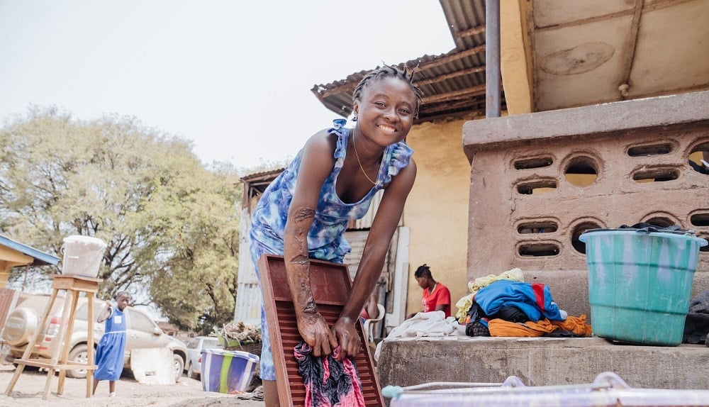 Meisje is aan het wassen op een wasbord met een arm met een brandwond erop